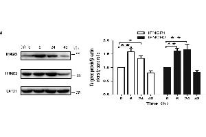 IFN-γ increased rates of autophagy in primary BMECs in vitro. (RTN4RL2 抗体  (AA 241-337))