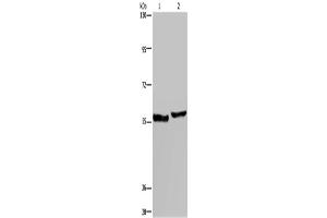 Western Blotting (WB) image for anti-Solute Carrier Family 1 (High Affinity Aspartate/glutamate Transporter), Member 6 (SLC1A6) antibody (ABIN2431275) (SLC1A6 抗体)