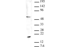 Pht1 / H2AZ acetyl pAb tested by Western blot. (Pht1 / Histone H2A.Zac (N-Term) 抗体)