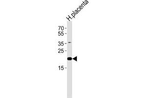 Western Blotting (WB) image for anti-Chromosome 2 Open Reading Frame 74 (C2ORF74) antibody (ABIN3004714) (C2ORF74 抗体)