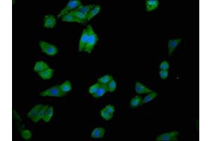 Immunofluorescence staining of HepG2 cells with ABIN7147616 at 1:100, counter-stained with DAPI. (Choline Kinase alpha 抗体  (AA 79-173))