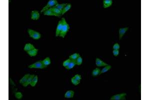 Immunofluorescence staining of HepG2 cells with ABIN7147616 at 1:100, counter-stained with DAPI. (Choline Kinase alpha 抗体  (AA 79-173))