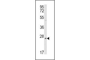 Western Blotting (WB) image for anti-Protein Tyrosine Phosphatase Type IVA, Member 3 (PTP4A3) antibody (ABIN392854)