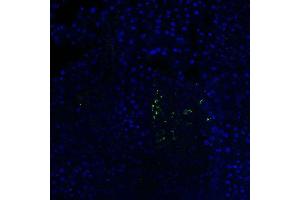 Mouse Pancreas (C57BL/6 strain) fixed in 4% PFA for 2 hours at RT, then transferred to 30% sucrose overnight at 4 °C before embedding in OCT mounting medium. (Somatostatin 抗体  (AA 75-107))