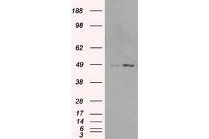 Western Blotting (WB) image for anti-LEM Domain Containing 3 (LEMD3) antibody (ABIN1499117) (LEMD3 抗体)