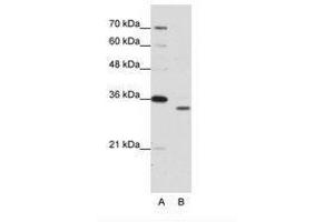 Image no. 1 for anti-Proteasome Subunit alpha Type 1 (PSMA1) (N-Term) antibody (ABIN203038) (PSMA1 抗体  (N-Term))