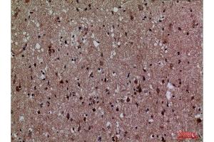 Immunohistochemistry (IHC) image for anti-Cyclin-Dependent Kinase 4 (CDK4) (N-Term) antibody (ABIN3187734)