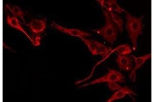 ABIN6275555 staining 293 by IF/ICC. (SERPINB4 抗体  (C-Term))