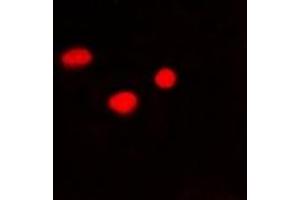 Immunofluorescent analysis of PSMB10 staining in Hela cells. (PSMB10 抗体)