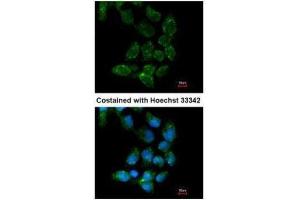 ICC/IF Image Immunofluorescence analysis of paraformaldehyde-fixed A431, using USP15, antibody at 1:200 dilution. (USP15 抗体  (C-Term))