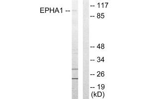 Western blot analysis of extracts from COLO205 cells, using EPHA1 antibody. (EPHA1 抗体  (Internal Region))