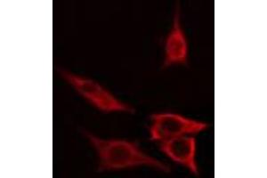 ABIN6267676 staining COLO205 cells by IF/ICC. (B-Cell Linker 抗体  (pTyr96))