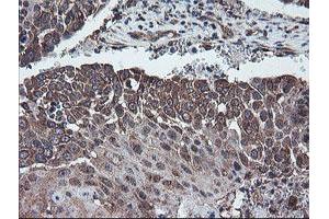 Image no. 10 for anti-Diphthamide Biosynthesis Protein 2 (DPH2) antibody (ABIN1497893)