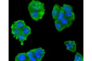 SW480 cells were fixed in paraformaldehyde, permeabilized with 0. (SMAD3 抗体)