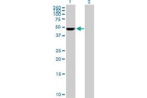 Western Blot analysis of UCKL1 expression in transfected 293T cell line by UCKL1 MaxPab polyclonal antibody. (UCKL1 抗体  (AA 1-419))
