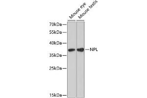 Western blot analysis of extracts of various cell lines, using NPL antibody (ABIN6132931, ABIN6144778, ABIN6144779 and ABIN6224929) at 1:3000 dilution. (NPL 抗体  (AA 1-250))