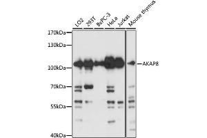 Western blot analysis of extracts of various cell lines, using  antibody (ABIN3017254, ABIN3017255, ABIN3017256 and ABIN6220015) at 1:3000 dilution. (AKAP8 抗体  (AA 480-692))