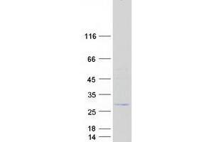 ACER1 Protein (Myc-DYKDDDDK Tag)