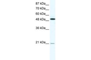 Western Blotting (WB) image for anti-Tumor Necrosis Factor Receptor Superfamily, Member 11b (TNFRSF11B) antibody (ABIN2463647) (Osteoprotegerin 抗体)