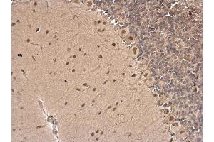 Immunohistochemistry (IHC) image for anti-Excision Repair Cross-Complementing Rodent Repair Deficiency, Complementation Group 6 (ERCC6) (Internal Region) antibody (ABIN2855858)