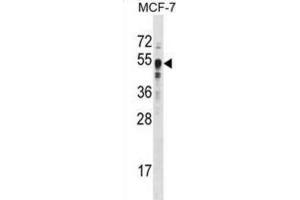 Western Blotting (WB) image for anti-SET Domain Containing 8 Pseudogene 1 (SETD8P1) antibody (ABIN2996451) (SET7 抗体)