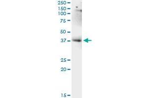 Immunoprecipitation of LUC7L transfected lysate using anti-LUC7L monoclonal antibody and Protein A Magnetic Bead , and immunoblotted with LUC7L monoclonal antibody.