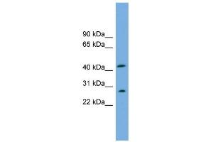WB Suggested Anti-RABEPK Antibody Titration: 0. (RABEPK 抗体  (N-Term))