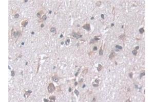 Detection of STIP1 in Human Cerebrum Tissue using Polyclonal Antibody to Stress Induced Phosphoprotein 1 (STIP1) (STIP1 抗体  (AA 1-169))