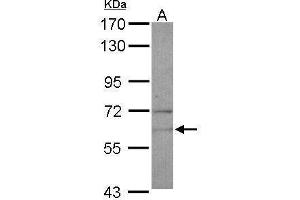 WB Image Sample (30 ug of whole cell lysate) A: U87-MG 7. (NARS 抗体)