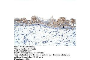 Rabbit Anti-DAZ2 Antibody  Paraffin Embedded Tissue: Human Skin Cellular Data: Squamous epithelial cells Antibody Concentration: 4. (DAZ2 抗体  (N-Term))