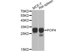 Western blot analysis of extracts of various cell lines, using POP4 Antibody. (RPP29 抗体)