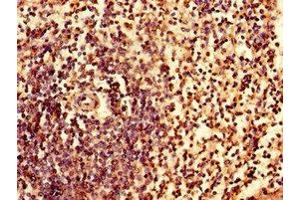 Immunohistochemistry of paraffin-embedded human spleen tissue using ABIN7156631 at dilution of 1:100 (IRF7 抗体  (AA 131-289))