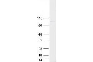 Western Blotting (WB) image for Polymerase (DNA Directed), eta (POLH) protein (Myc-DYKDDDDK Tag) (ABIN2729308)