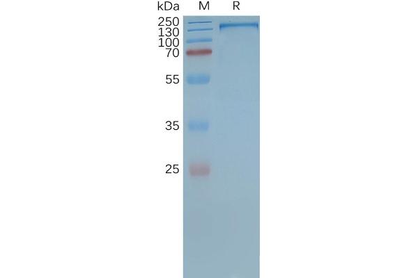 Malic Enzyme Complex, Mitochondrial (Mod2) 蛋白