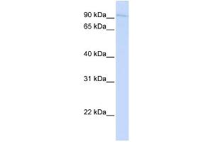WB Suggested Anti-SYDE1 Antibody Titration:  0. (SYDE1 抗体  (N-Term))