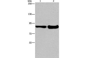 Western Blot analysis of Mouse lung and liver tissue using MAPRE3 Polyclonal Antibody at dilution of 1:1050 (MAPRE3 抗体)
