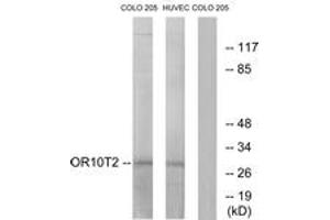 Western blot analysis of extracts from HuvEc/COLO cells, using OR10T2 Antibody. (OR10T2 抗体  (AA 231-280))