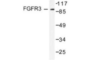 Image no. 1 for anti-Fibroblast Growth Factor Receptor 3 (FGFR3) antibody (ABIN265418) (FGFR3 抗体)