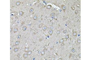 Immunohistochemistry of paraffin-embedded Mouse brain using EIF3C Polyclonal Antibody at dilution of 1:100 (40x lens). (EIF3C 抗体)