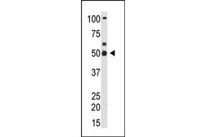 Image no. 1 for anti-YY1 Transcription Factor (YY1) (N-Term) antibody (ABIN357756) (YY1 抗体  (N-Term))