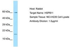 Image no. 1 for anti-Heat Shock Protein Family B (Small), Member 11 (HSPB11) (AA 6-55) antibody (ABIN6749885) (HSPB11 抗体  (AA 6-55))