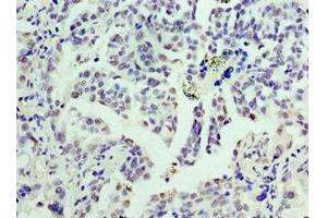 Immunohistochemistry (IHC) image for anti-Cyclin D3 (CCND3) (AA 1-292) antibody (ABIN7153394)