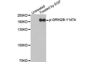 Western blot analysis of extracts from A431 cells, using Phospho-GRIN2B-Y1474 antibody. (GRIN2B 抗体  (pTyr1474))