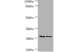 Western blot All lanes: GSTM4 antibody at 10 μg/mL Lane 1: Rat lung tissue Lane 2: MCF-7 whole cell lysate Secondary Goat polyclonal to rabbit IgG at 1/10000 dilution Predicted band size: 26, 23, 19 kDa Observed band size: 26 kDa (GSTM4 抗体  (AA 1-218))