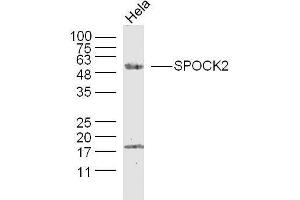 Human Hela cells probed with SPOCK2/Testican 2 Polyclonal Antibody, unconjugated  at 1:300 overnight at 4°C followed by a conjugated secondary antibody at 1:10000 for 90 minutes at 37°C. (SPOCK2/Testican 2 抗体  (AA 61-160))