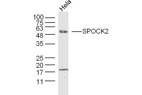 SPOCK2/Testican 2 抗体  (AA 61-160)