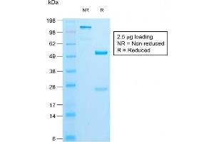 SDS-PAGE Analysis of Purified Insulin Rabbit Recombinant Monoclonal Antibody (IRDN/1980R). (Recombinant Insulin 抗体)