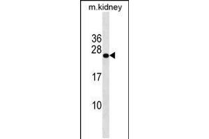 Western blot analysis in mouse kidney tissue lysates (35ug/lane). (GRPEL2 抗体  (N-Term))
