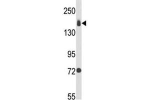 Western blot analysis of Integrin alpha 2 antibody and MDA-MB231 lysate (ITGA2 抗体  (AA 1023-1049))