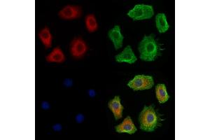 ABIN7094431 and ABIN7098479 staining Hela cells by IF/ICC. (PREP 抗体  (Internal Region))